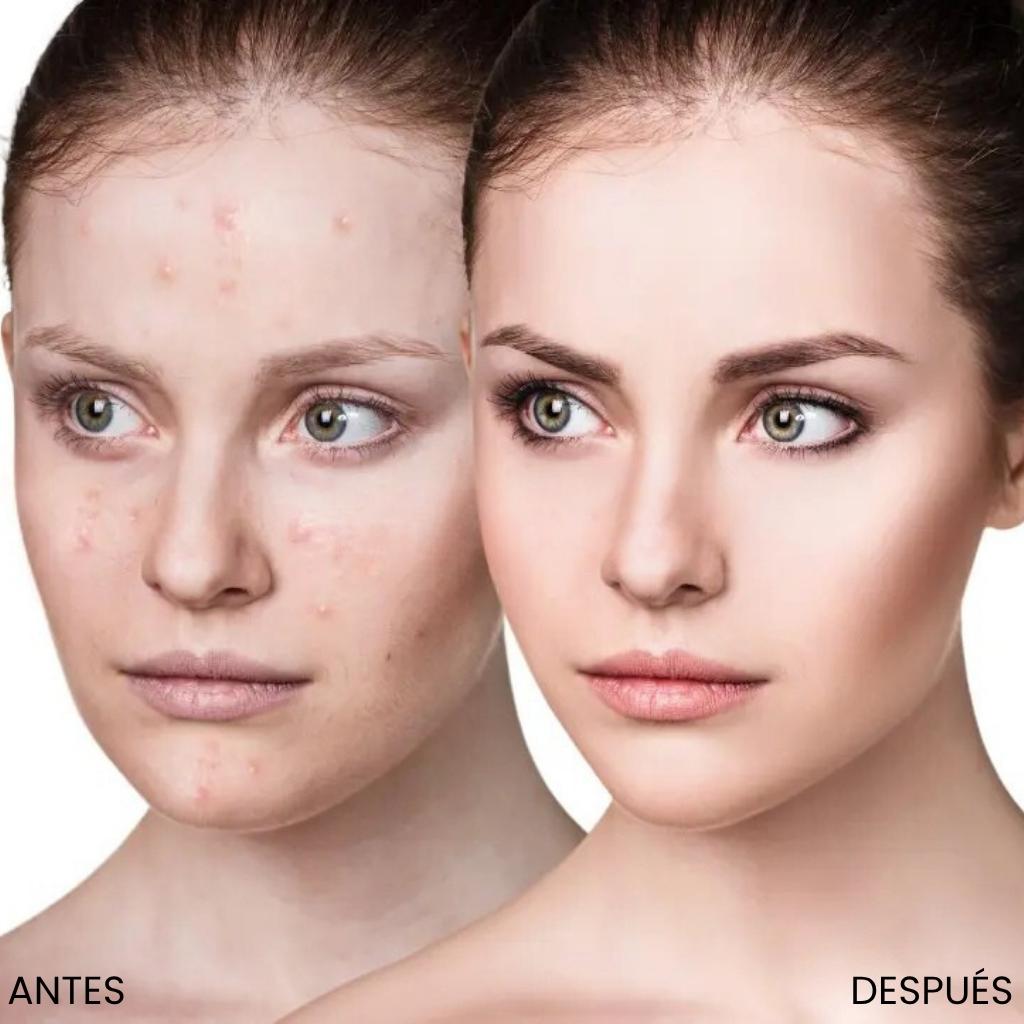 LA MASCARILLA Nº1 GREENPOP